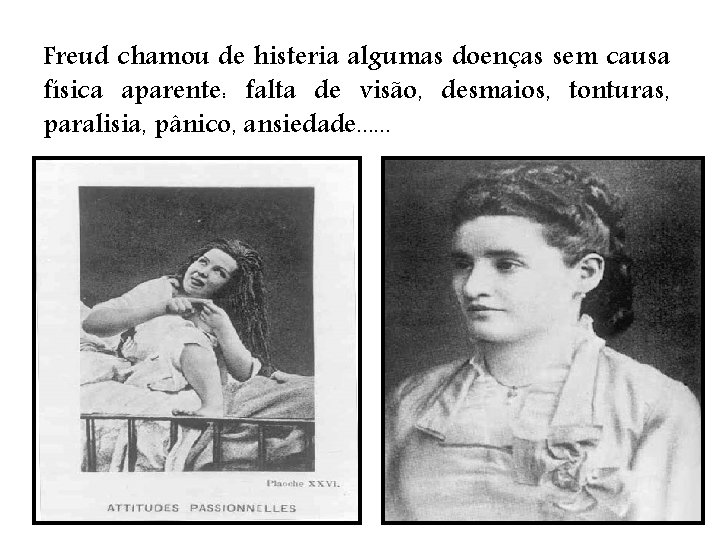 Freud chamou de histeria algumas doenças sem causa física aparente: falta de visão, desmaios,