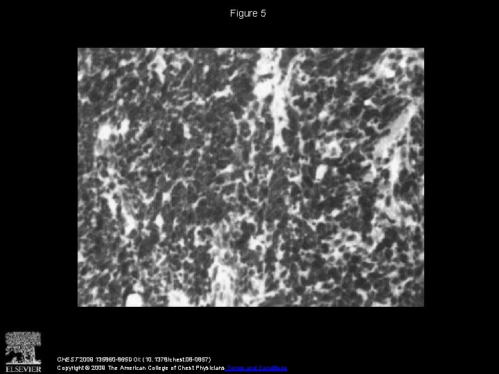 Figure 5 CHEST 2009 135860 -865 DOI: (10. 1378/chest. 08 -0857) Copyright © 2009