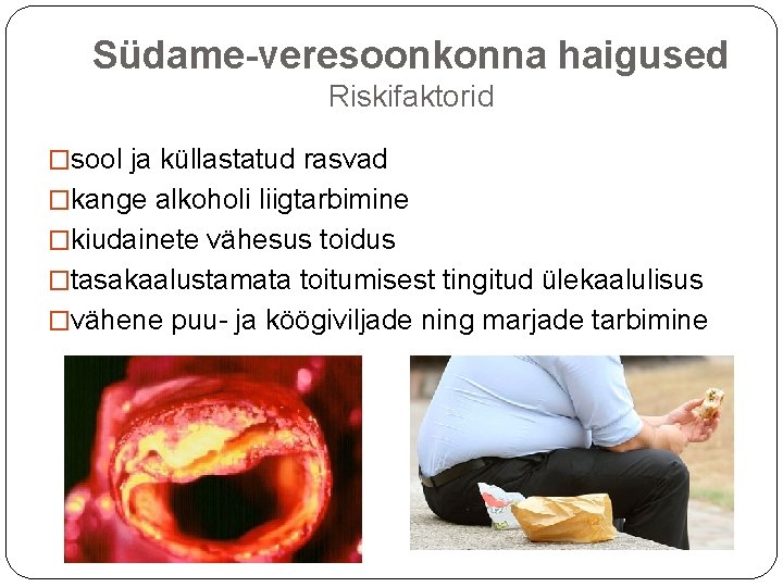 Südame-veresoonkonna haigused Riskifaktorid �sool ja küllastatud rasvad �kange alkoholi liigtarbimine �kiudainete vähesus toidus �tasakaalustamata