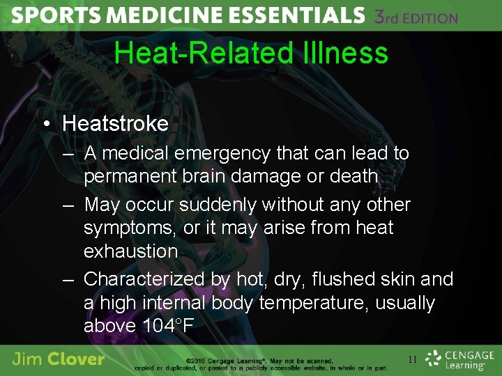Heat-Related Illness • Heatstroke – A medical emergency that can lead to permanent brain