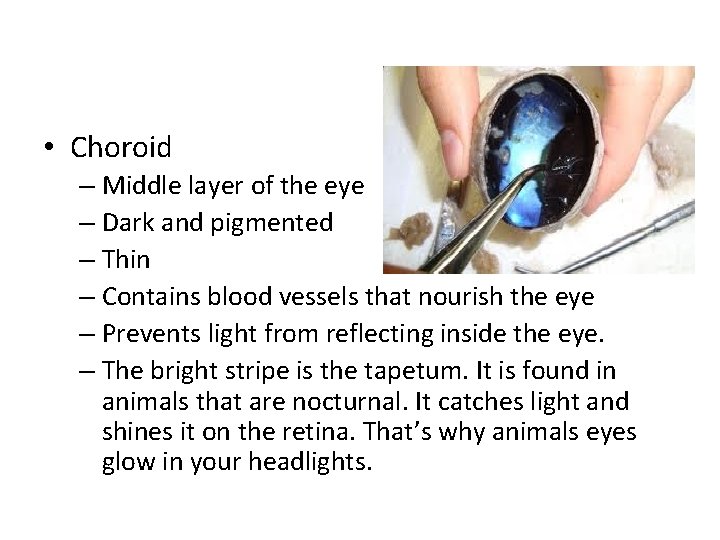  • Choroid – Middle layer of the eye – Dark and pigmented –