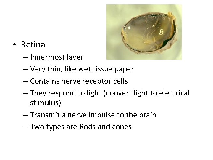  • Retina – Innermost layer – Very thin, like wet tissue paper –