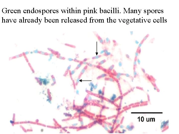 Green endospores within pink bacilli. Many spores have already been released from the vegetative
