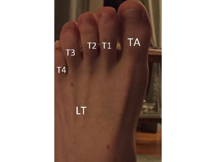 T 2 T 1 T 3 T 4 LT TA 