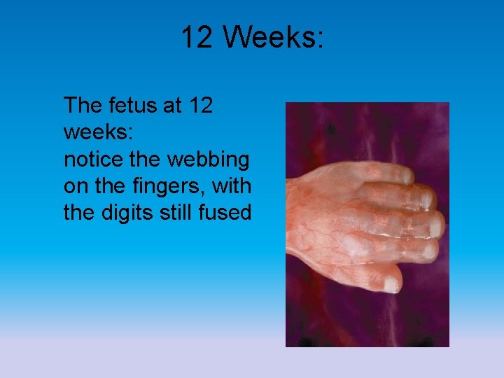 12 Weeks: The fetus at 12 weeks: notice the webbing on the fingers, with