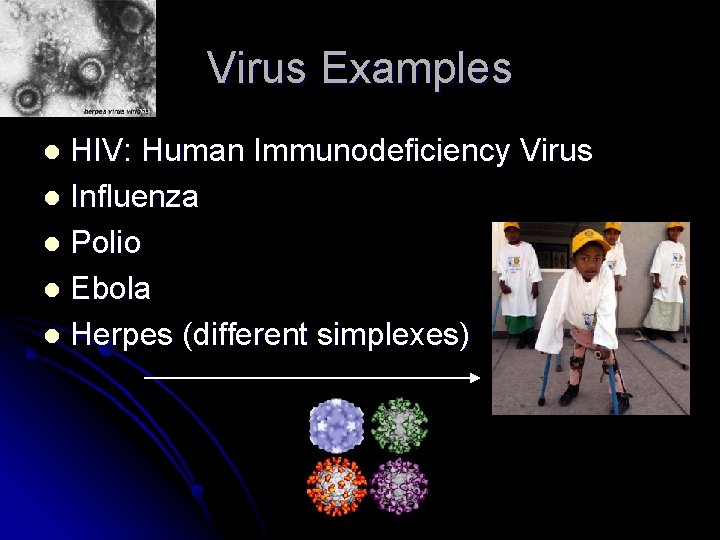 Virus Examples HIV: Human Immunodeficiency Virus l Influenza l Polio l Ebola l Herpes