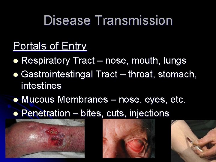 Disease Transmission Portals of Entry Respiratory Tract – nose, mouth, lungs l Gastrointestingal Tract