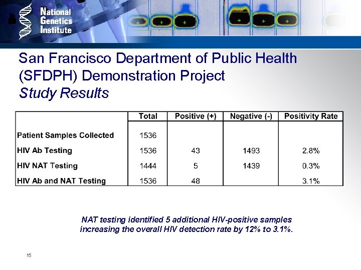 San Francisco Department of Public Health (SFDPH) Demonstration Project Study Results NAT testing identified