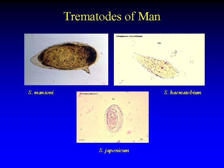 Trematodes of Man S. mansoni S. haematobium S. japonicum 