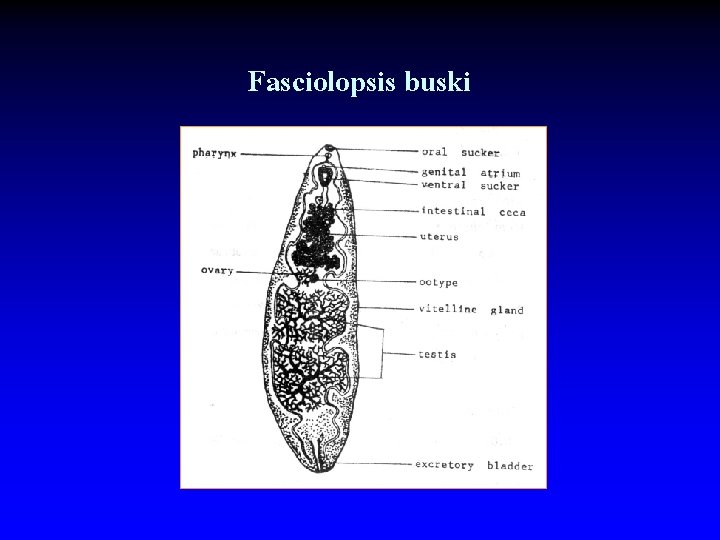 Fasciolopsis buski 