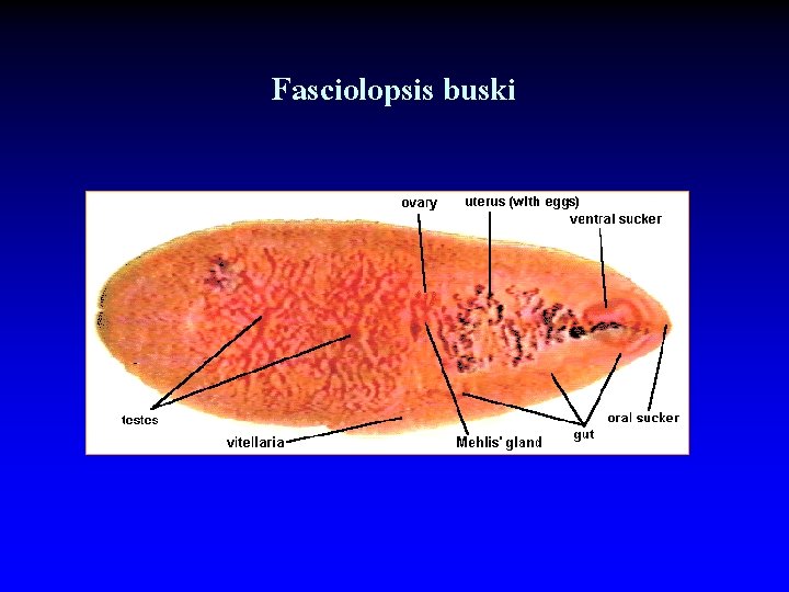 Fasciolopsis buski 