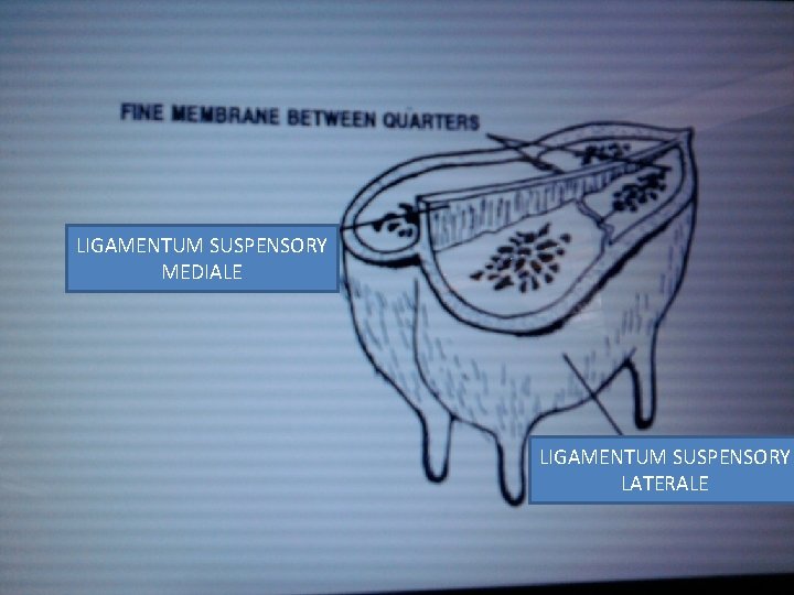 LIGAMENTUM SUSPENSORY MEDIALE LIGAMENTUM SUSPENSORY LATERALE 