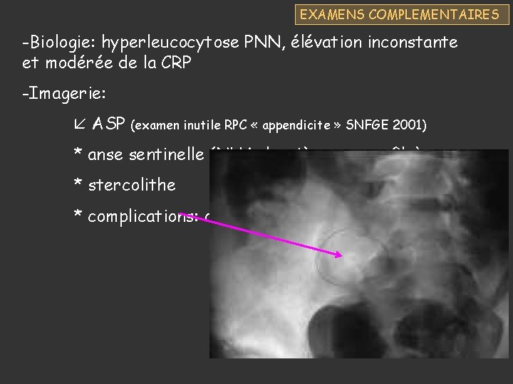 EXAMENS COMPLEMENTAIRES -Biologie: hyperleucocytose PNN, élévation inconstante et modérée de la CRP -Imagerie: ASP