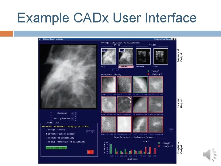 Example CADx User Interface Example CADx User Interface