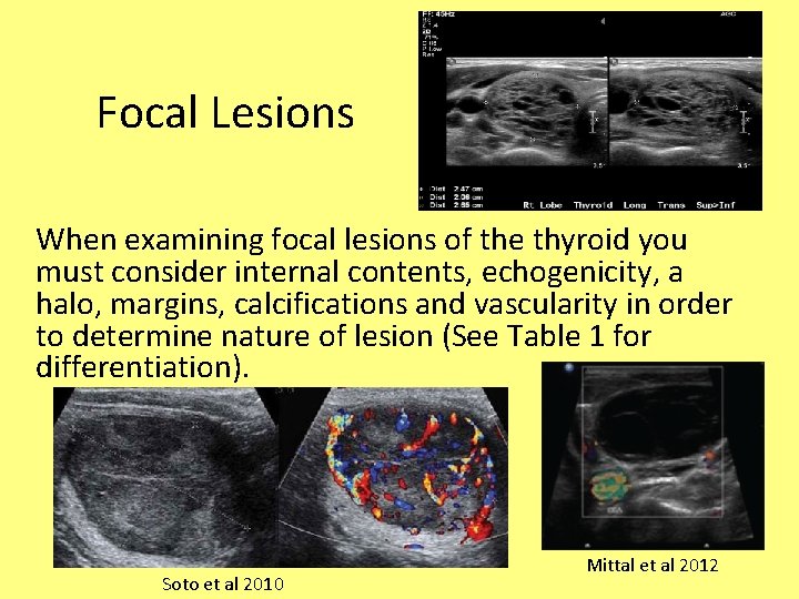 Focal Lesions When examining focal lesions of the thyroid you must consider internal contents,