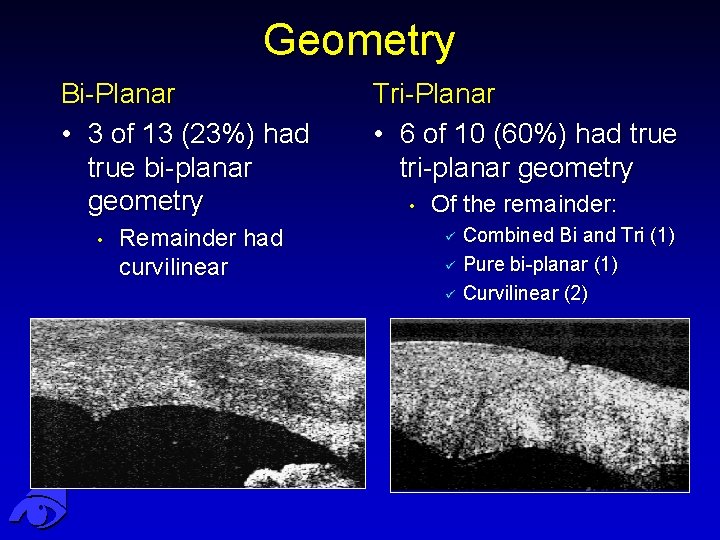 Analysis of Clear Corneal Incision Architecture with Anterior