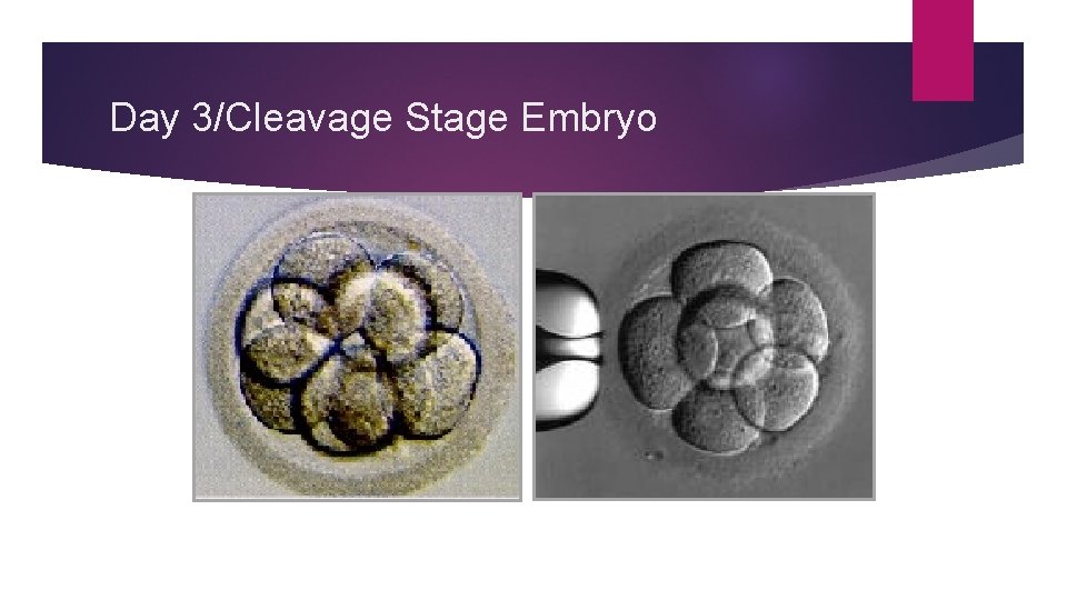 Day 3/Cleavage Stage Embryo 