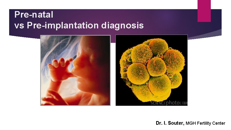 Pre-natal vs Pre-implantation diagnosis Dr. I. Souter, MGH Fertility Center 