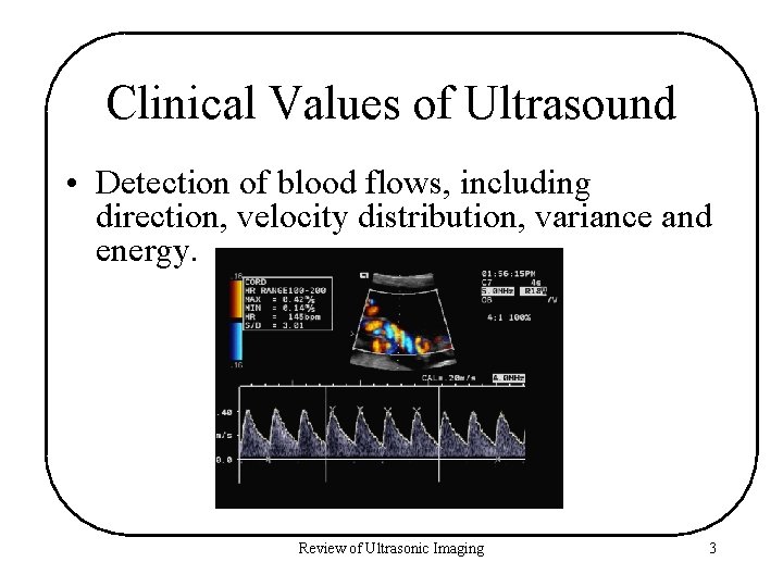 Clinical Values of Ultrasound • Detection of blood flows, including direction, velocity distribution, variance