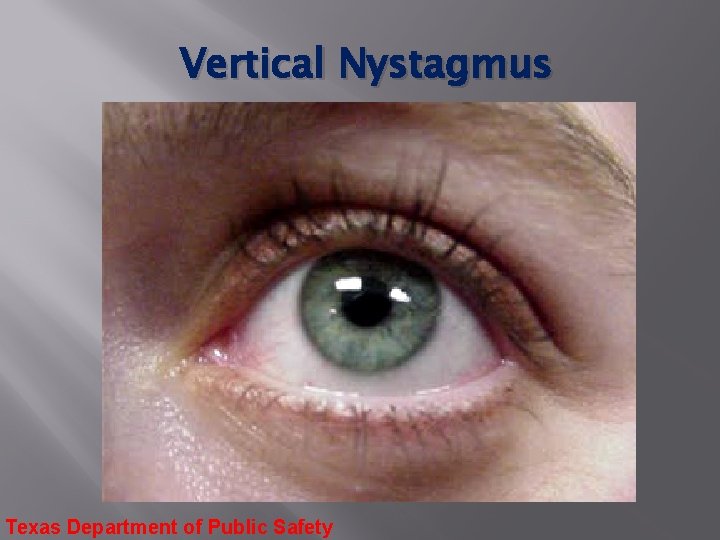 Vertical Nystagmus Texas Department of Public Safety 