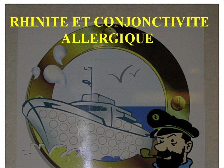 RHINITE ET CONJONCTIVITE ALLERGIQUE 