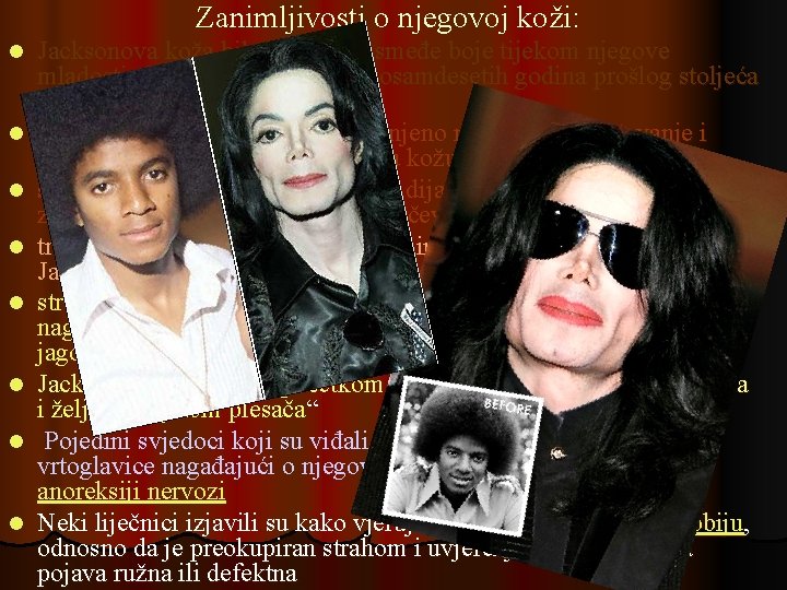Zanimljivosti o njegovoj koži: l l l l Jacksonova koža bila je srednje smeđe