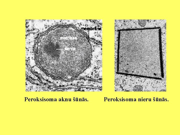 Peroksisoma aknu šūnās. Peroksisoma nieru šūnās. 