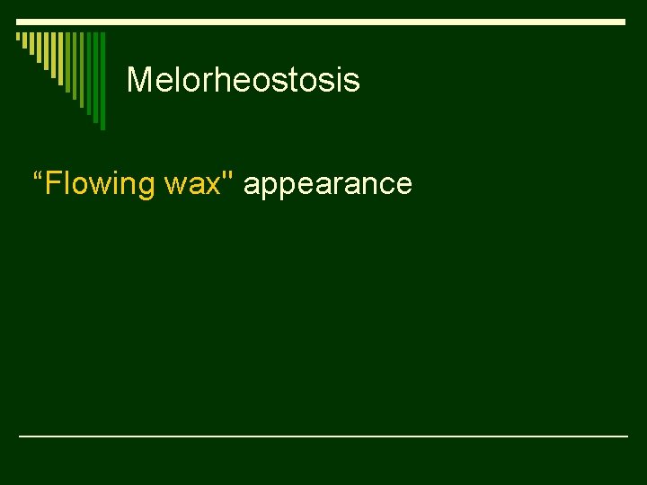 Melorheostosis “Flowing wax" appearance 