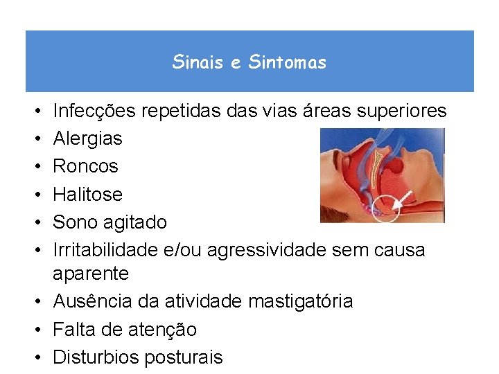 Sinais e Sintomas • • • Infecções repetidas vias áreas superiores Alergias Roncos Halitose