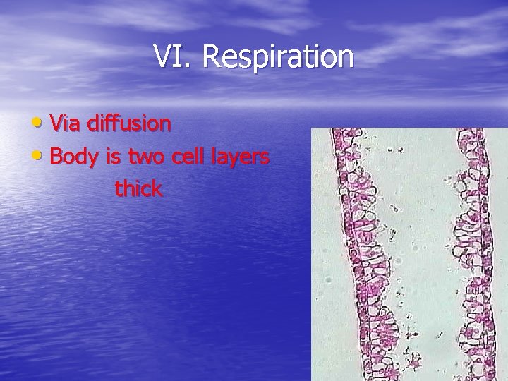 VI. Respiration • Via diffusion • Body is two cell layers thick 