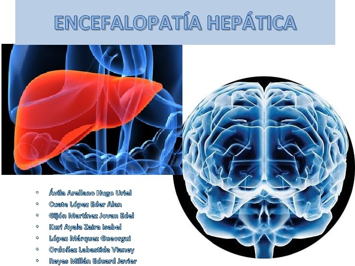 ENCEFALOPATÍA HEPÁTICA • • Ávila Arellano Hugo Uriel Cuate López Eder Alan Gijón Martínez