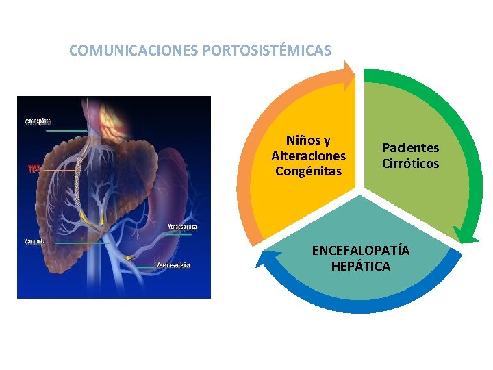 COMUNICACIONES PORTOSISTÉMICAS Niños y Alteraciones Congénitas Pacientes Cirróticos ENCEFALOPATÍA HEPÁTICA 