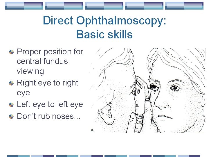 Direct Ophthalmoscopy: Basic skills Proper position for central fundus viewing Right eye to right