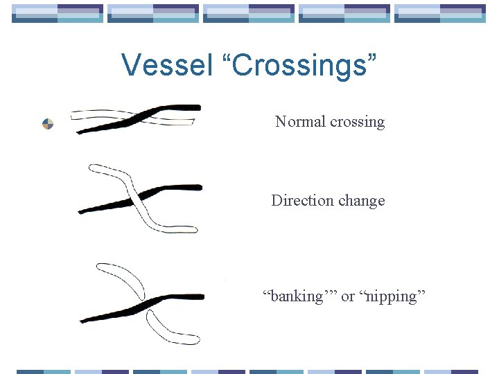 Vessel “Crossings” Normal crossing Direction change “banking’” or “nipping” 