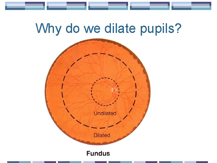 Why do we dilate pupils? 