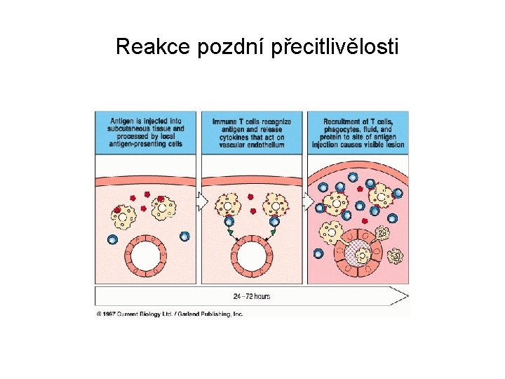 Reakce pozdní přecitlivělosti 