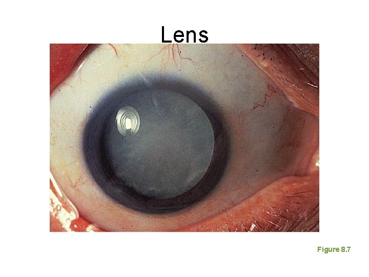 Lens Figure 8. 7 