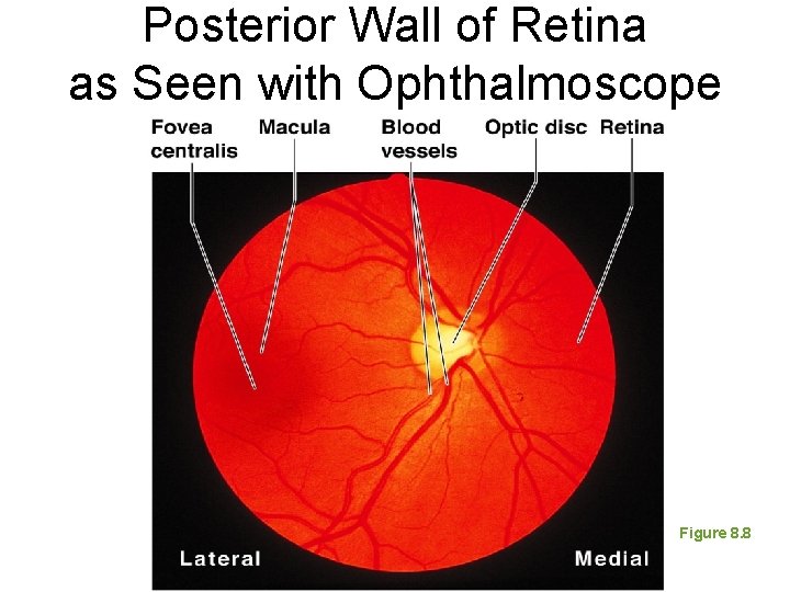 Posterior Wall of Retina as Seen with Ophthalmoscope Figure 8. 8 