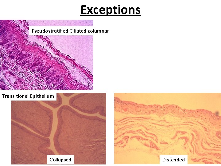 Exceptions Pseudostratified Ciliated columnar Transitional Epithelium Collapsed Distended 