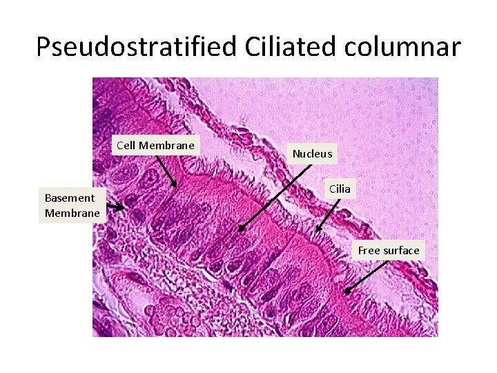 Pseudostratified Ciliated columnar Cell Membrane Basement Membrane Nucleus Cilia Free surface 