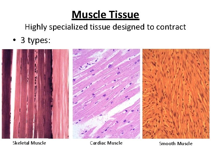 Muscle Tissue Highly specialized tissue designed to contract • 3 types: Skeletal Muscle Cardiac