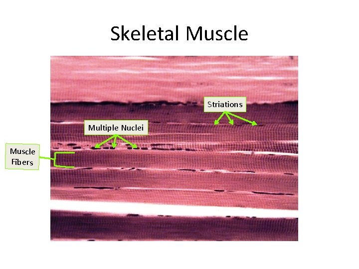 Skeletal Muscle Striations Multiple Nuclei Muscle Fibers 