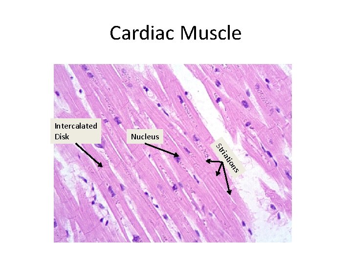 Cardiac Muscle Intercalated Disk Nucleus s ion iat Str 