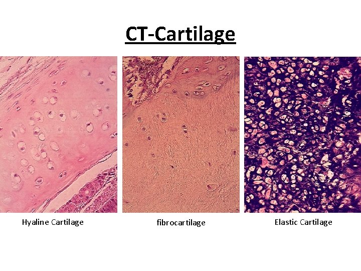 CT-Cartilage Hyaline Cartilage fibrocartilage Elastic Cartilage 