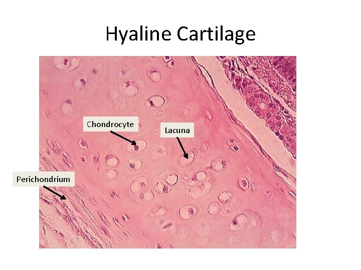 Hyaline Cartilage Chondrocyte Perichondrium Lacuna 