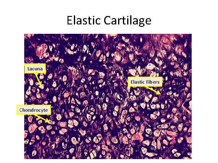 Elastic Cartilage Lacuna Elastic Fibers Chondrocyte 