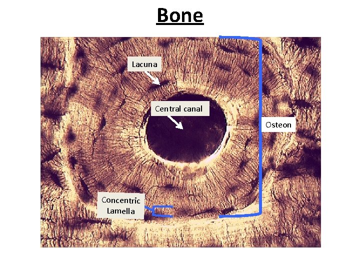 Bone Lacuna Central canal Osteon Concentric Lamella 