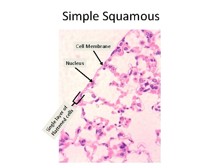 Simple Squamous Cell Membrane Sin Fla gle tte lay ne er d c of