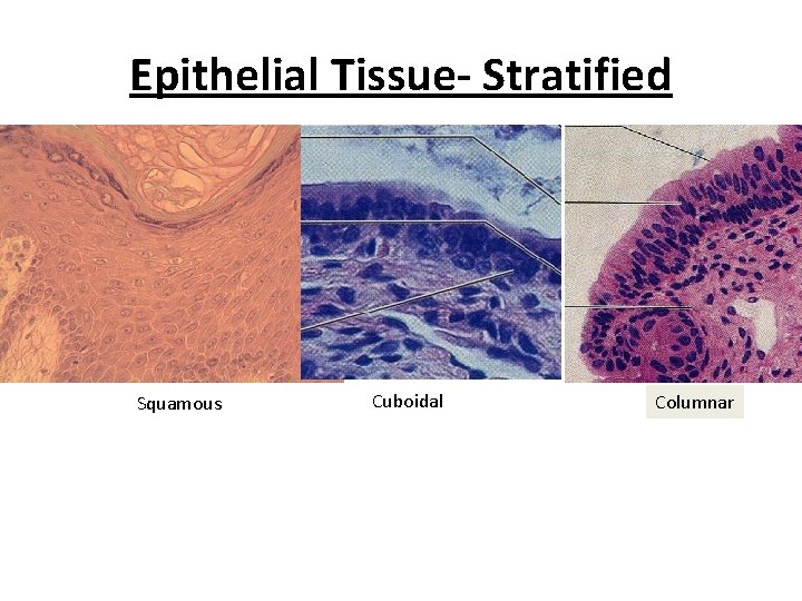 Epithelial Tissue- Stratified Squamous Cuboidal Columnar 