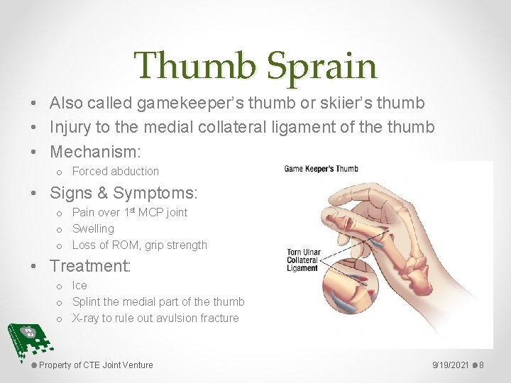 Thumb Sprain • Also called gamekeeper’s thumb or skiier’s thumb • Injury to the